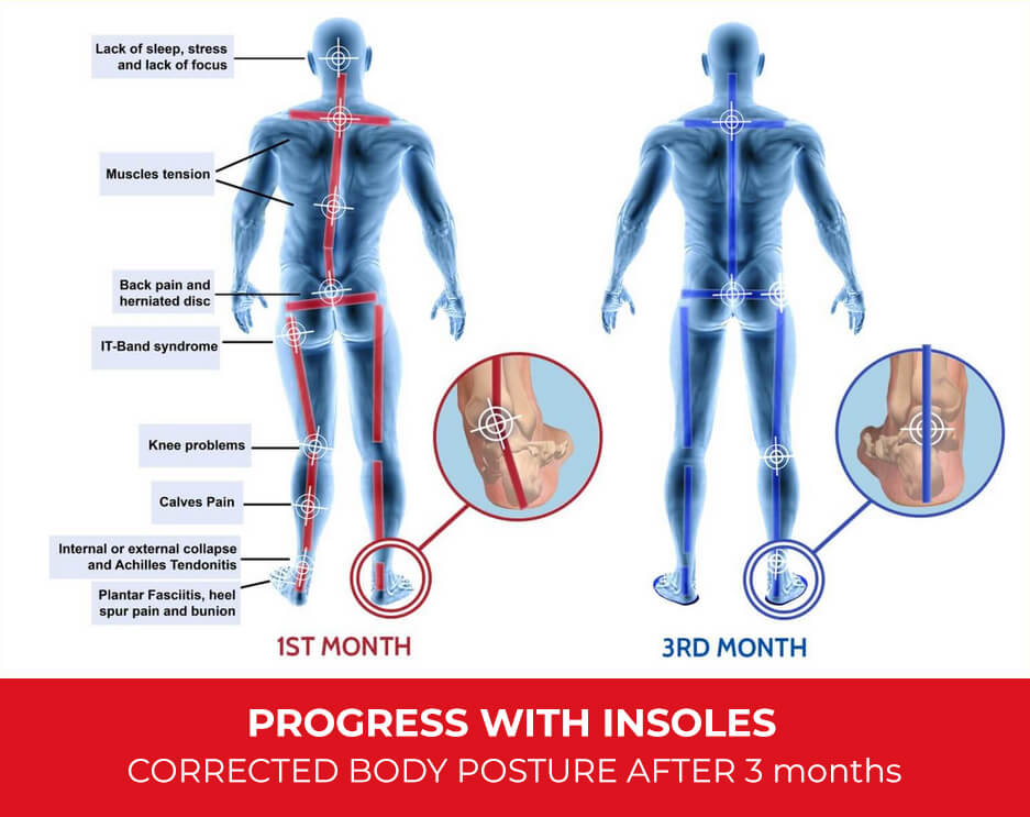 progress-with-insoles