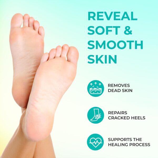 Happy Feet Foot Peel Mask, 03 Packs Original Exfoliant Foot Peel Mask, Callus Remover for Rough Cracked Dry Feet Dead Skin, Gift for Mom Dad - Image 3